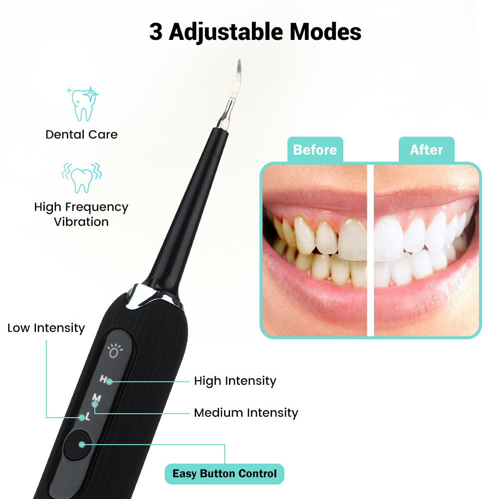 Electric Dental Cleaning Kit | Smile Therapy - Smile Therapy