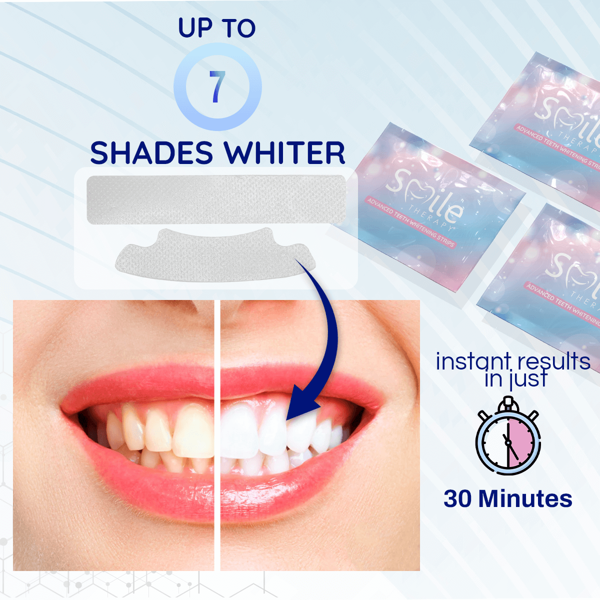 Premium Teeth Cleaning & Whitening Strips - Smile Therapy